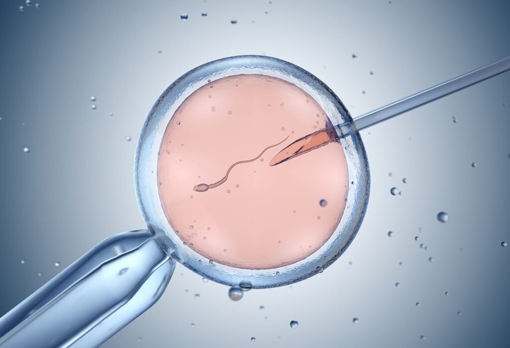 IVF