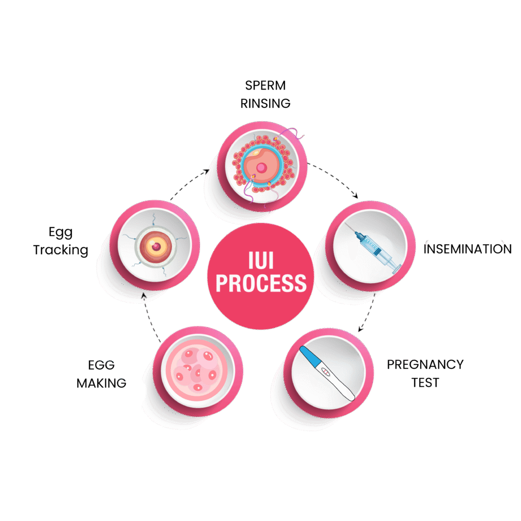 What is IUI Treatment?